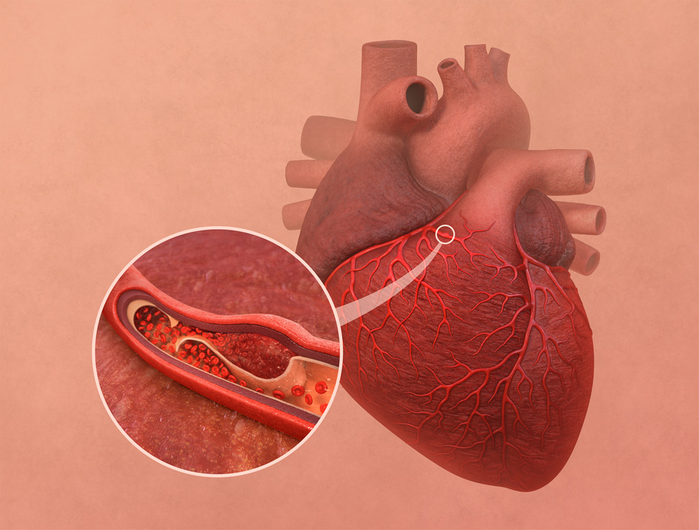 human heart with close-up view into the artery 