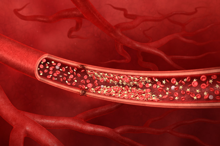 section of injured blood vessel with blood platelets