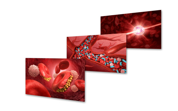 3d model sepsis in blood 