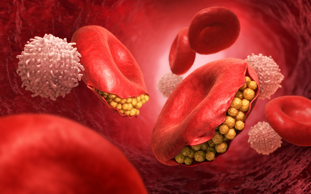 malaria